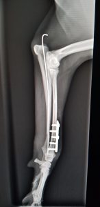 radio ulna